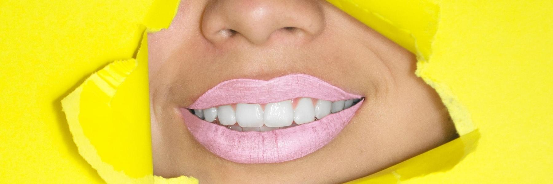 Woman smiling with Invisalign