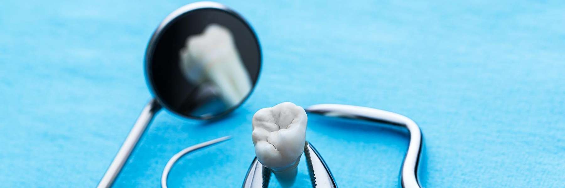 tooth extraction in Vallejo, CA
