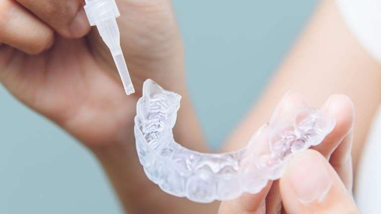 invisalign in Vallejo, CA