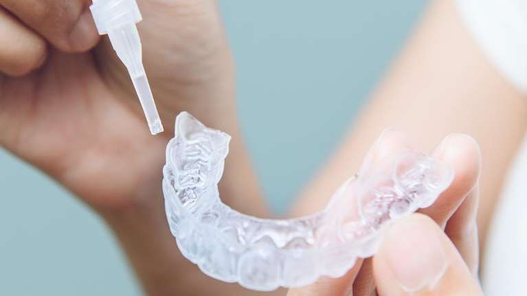 safe teeth whitening | what you need to know