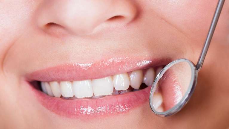 Maintaining Invisalign