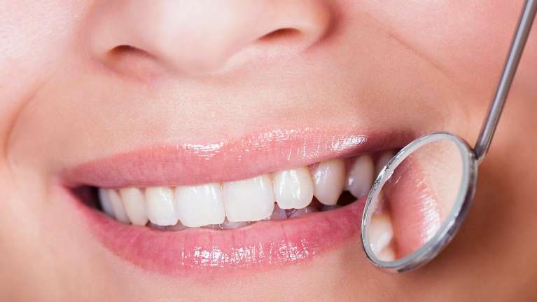 Invisalign Treatment in Vallejo CA