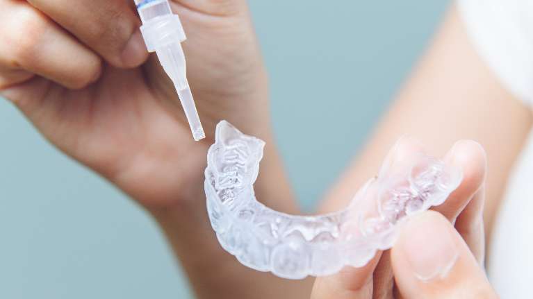 teeth whitening vallejo ca