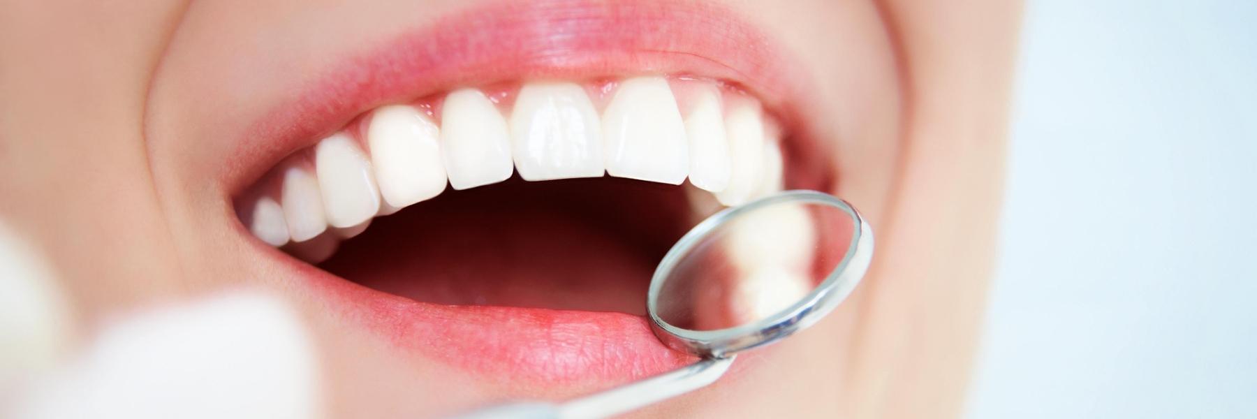 woman with perfect teeth