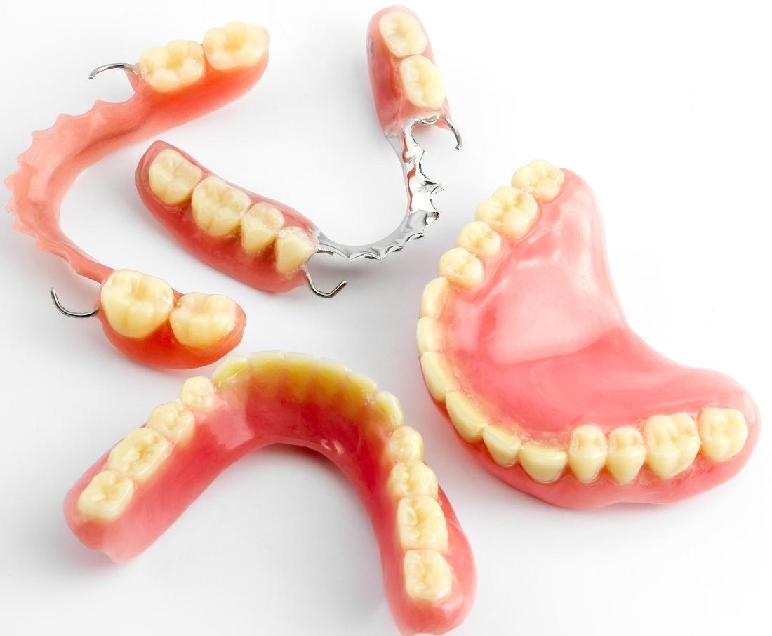 3 Reasons Why Dentures Might Be the Right Choice for You Blog